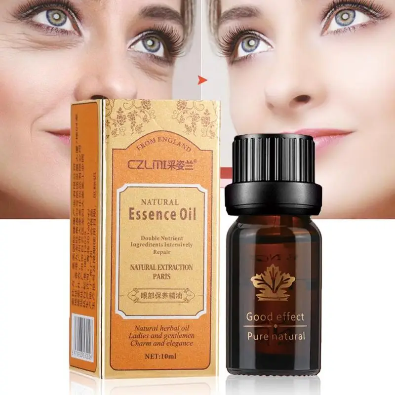 

10ml Compound Essential Oils For Eye Massage Aromatherapy Diffusers Eye Essence Oil Relieve Stress Anti-puffiness Dark Circle