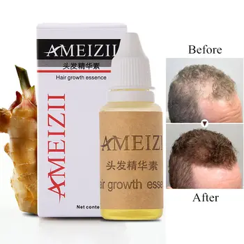 

20ml Fast Powerful Hair Growth Essence Hair Loss Products Essential Oil Liquid Treatment Preventing Hair Loss Hair Care Products