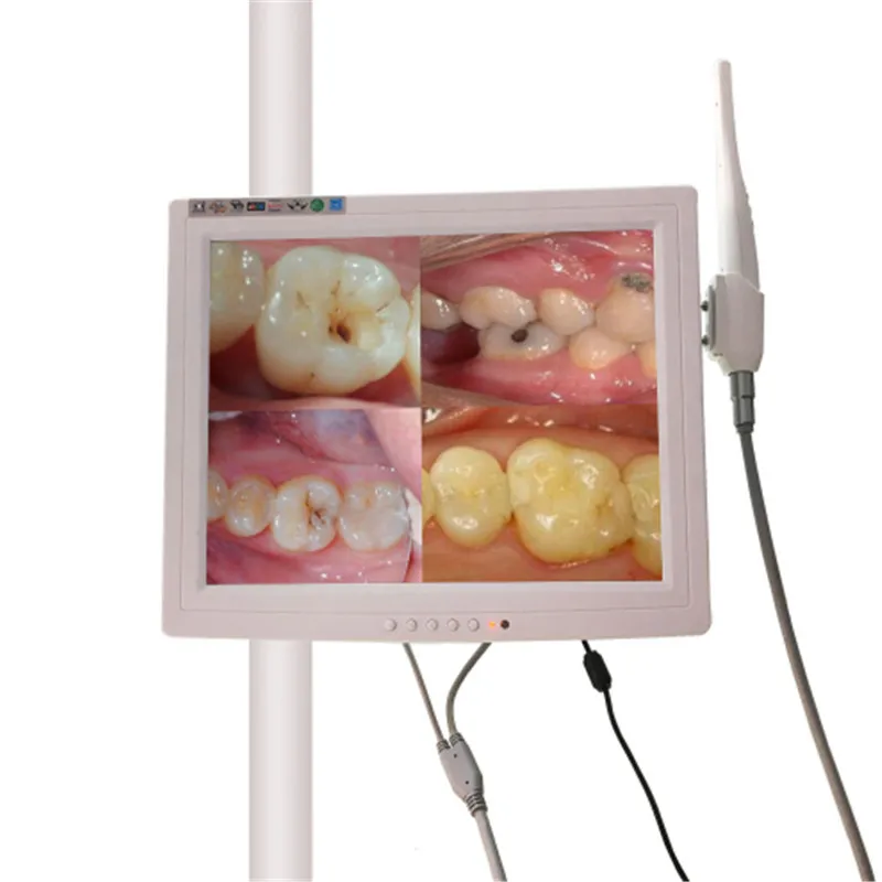 

A0003 with a 15 inch monitor VGA Intraoral Camera Endoscope Borescope 6 Led Light Dentist Camera dental camera odontologia