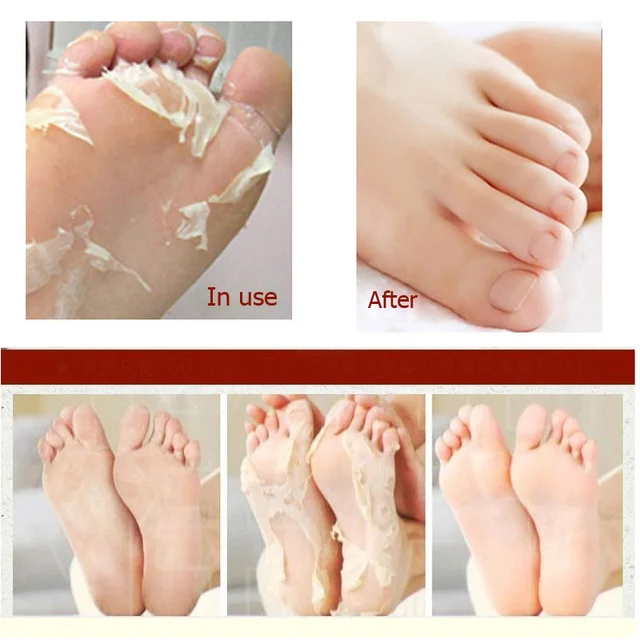 enlever peaux mortes aux pieds enlever peaux mortes aux pieds