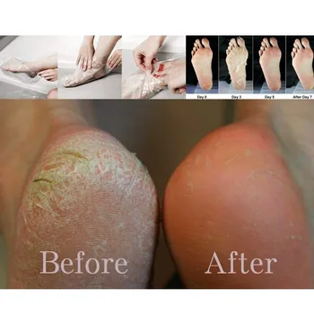 

4Pcs/2 Boxes Foot Peel Mask Foot Care tool Exfoliating Calluses and Dead Skin Remover For Feet With Moisturizing Whitten Cream