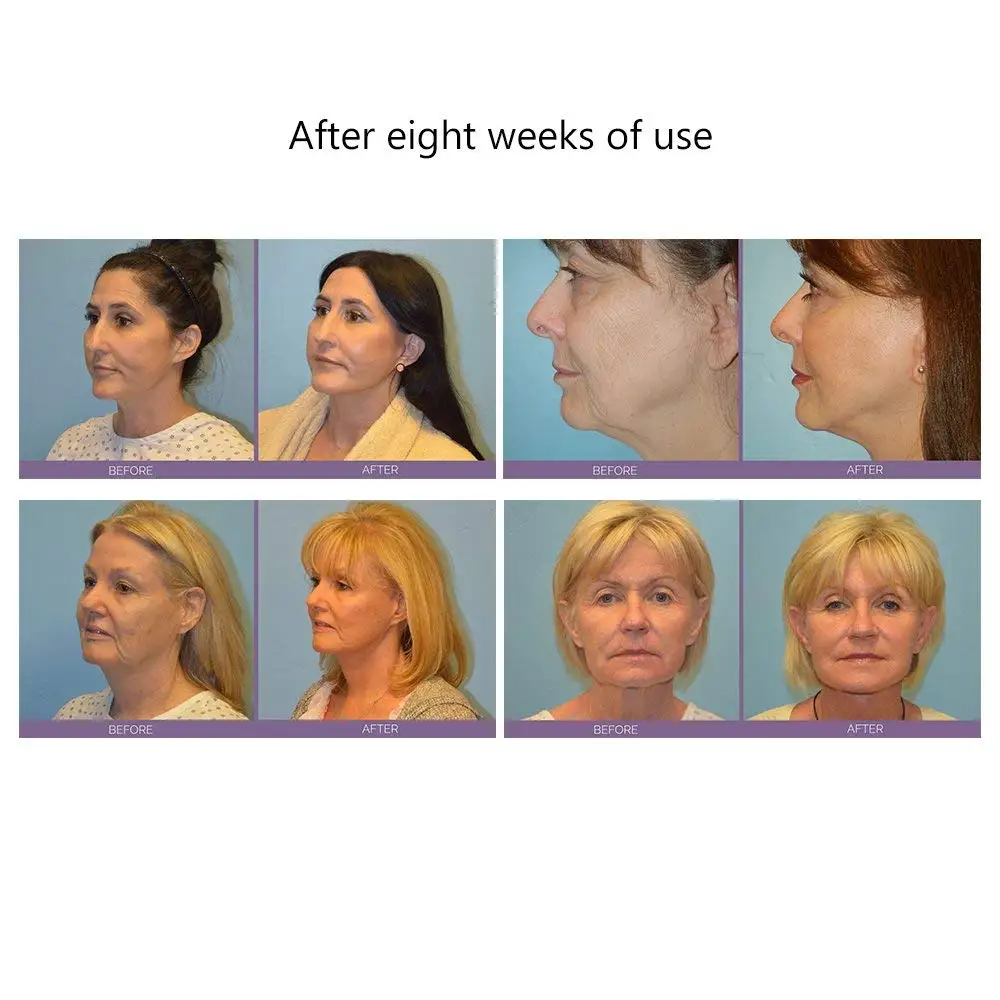 Face Levantamento da Máquina de Endurecimento da Pele Conjunto Massageador Microcorrente Tonificação Facial Beleza Antienvelhecimento Remover Rugas Rosto Dispositivo de Massagem 6 Máquina de levantamento de rosto pele aperto