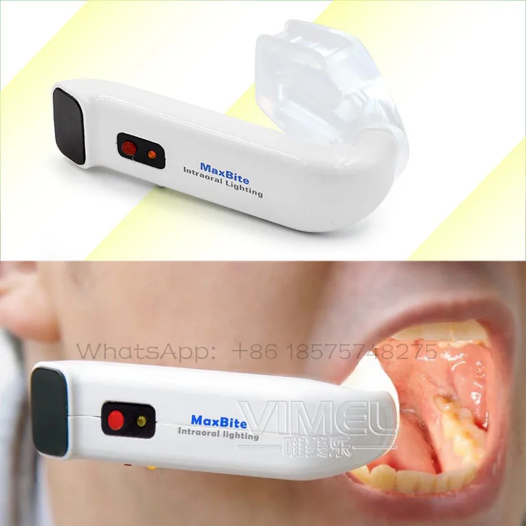 Dental-Intraoral-Light_01