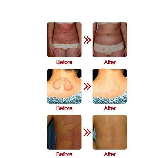 84c14ea1fbf710b071c936064cf175ad_HTB1pTvHadfvK1RjSspoq6zfNpXa8