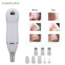 6 советы мини Алмазная дермабразия кожи машинка для пилинга вакуум/средство против акне чистка лица equ