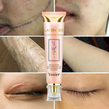 

Repair Scar cream Removal Acne Scars Stretch Marks Cream Surgical scar Burn For Body Pigmentation Corrector care