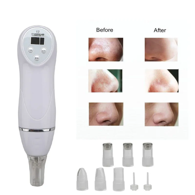 

Blackhead Vacuum Suction Pore Vacuum Cleaner Facial Blackhead Cleanser Tool Comedo Remover Blackhead Extractor