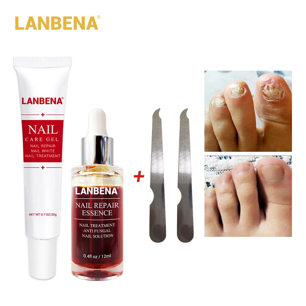 LANBENA Nail Care Gel+Nail Repair Essence Serum Treatment Remove Onychomycosis Toe Nourishing Hand And Foot 2PCS |
