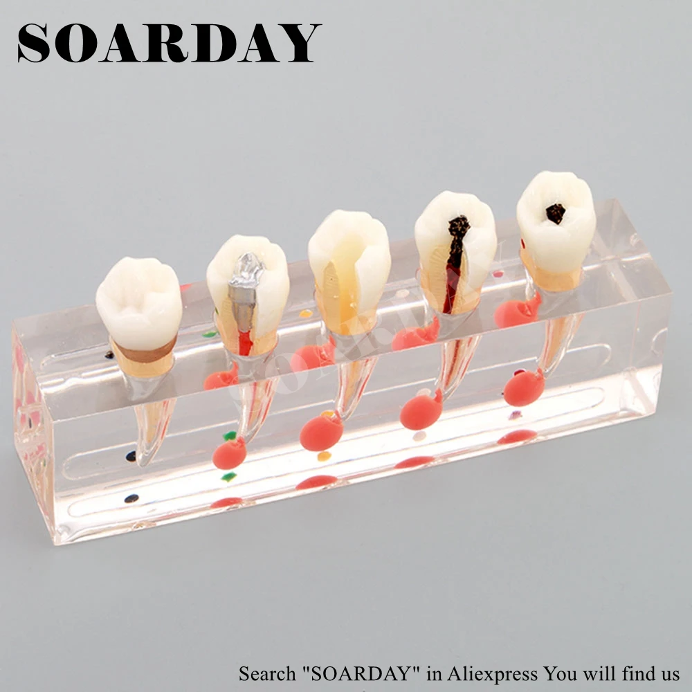 Endodontic Model (5)