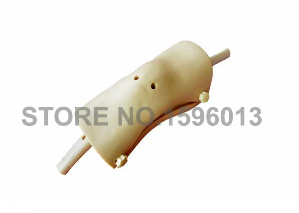 LV75 knee arthroscopy 1