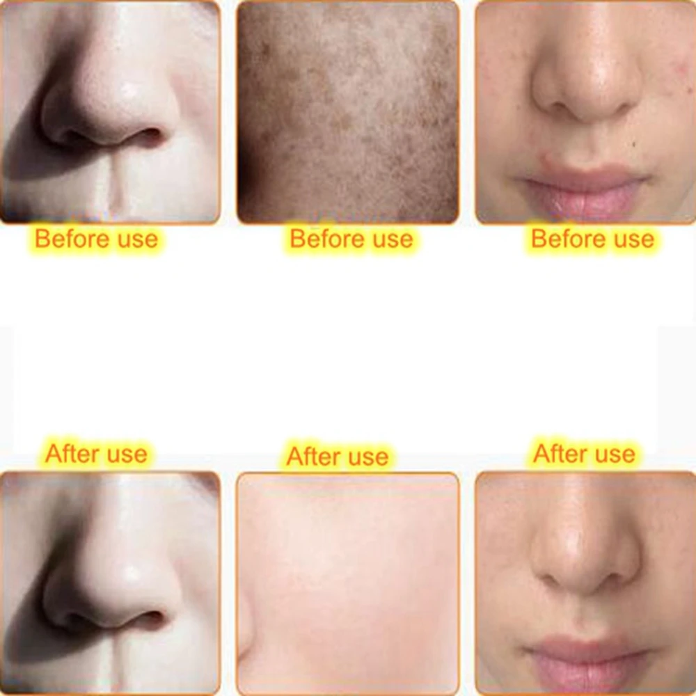 AFTER USE