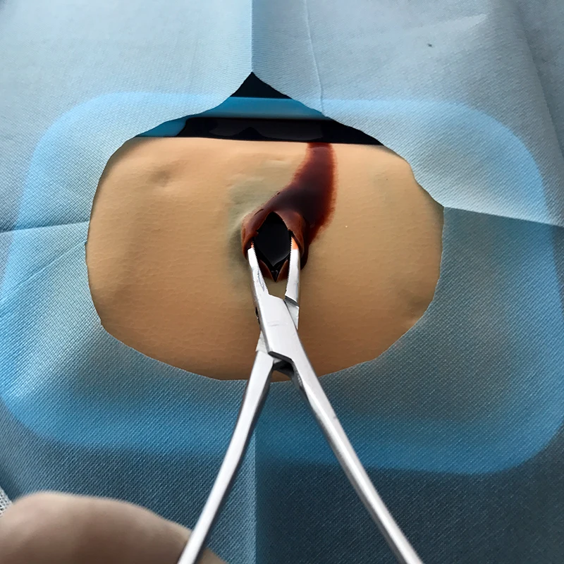Physician skills abscess incision drainage practice model medical teaching training demonstration silicone skin model