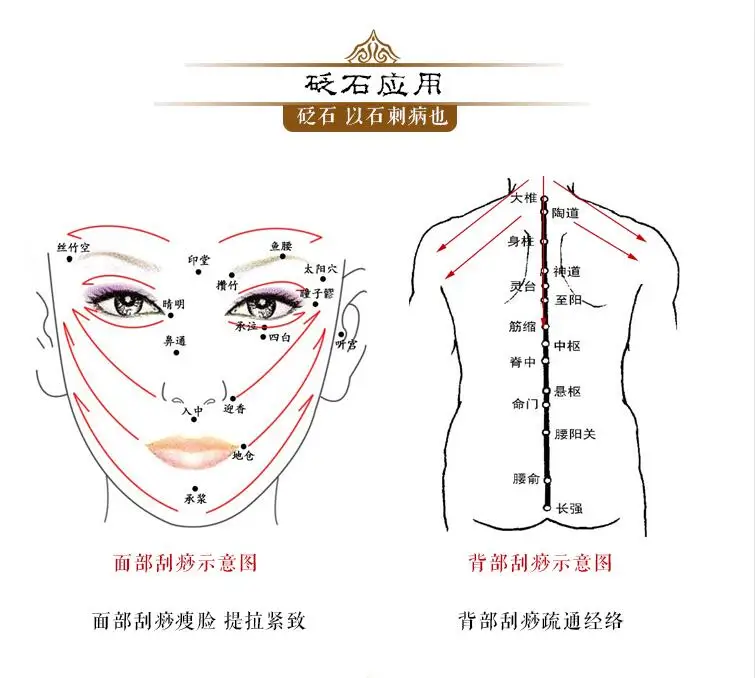 QQ20180224165756