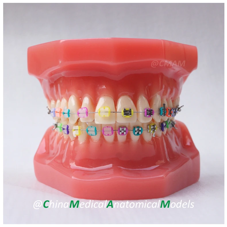 

No.13040, Dentist Patient Communication Oral Dental Ortho Metal and Ceramic Model, China Medical Anatomical Model