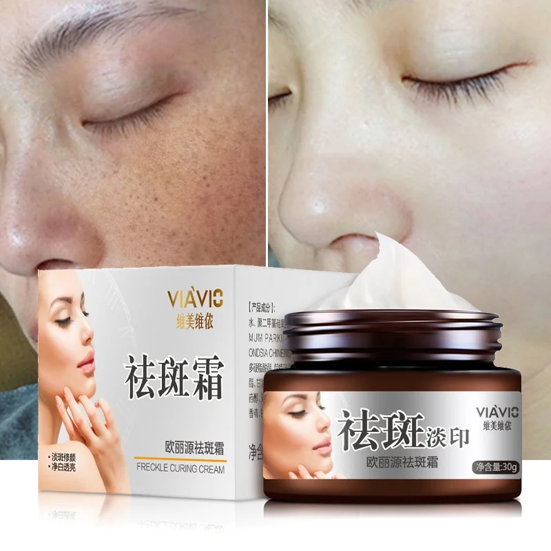 

Whitening Freckle Cream Remove Melasma Anti Dark Spot Remover Acne Pigment Melanin Speckle Blemish Face Care Cream 30g