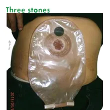 Один pc колостомия мешок с дренаж(классический Стома мешок) одноразовый уход за остомой