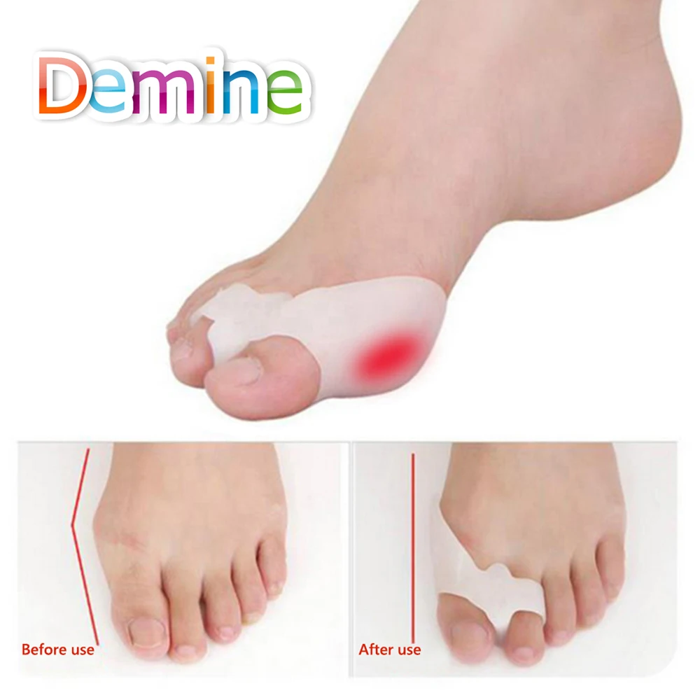 Silicone Gel Foot Toes Two Hole Toe Separator Thumb Valgus Protector Bunion Hallux Valgus Guard Feet Overlapping Pad Insert 2Pcs