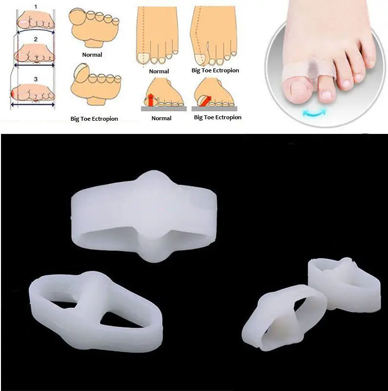1 пара разделители для пальцев ног выпрямители скрытие мозолей гель 2 отверстия обезболивающее средство по уходу за ногами