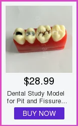Alta Qualidade Dental Typodon Dentes Modelo - Ortodôntico Steelteeth M8017 26 Alta qualidade dental m8017 typodon dentes modelo ortodôntico steelteeth modelo