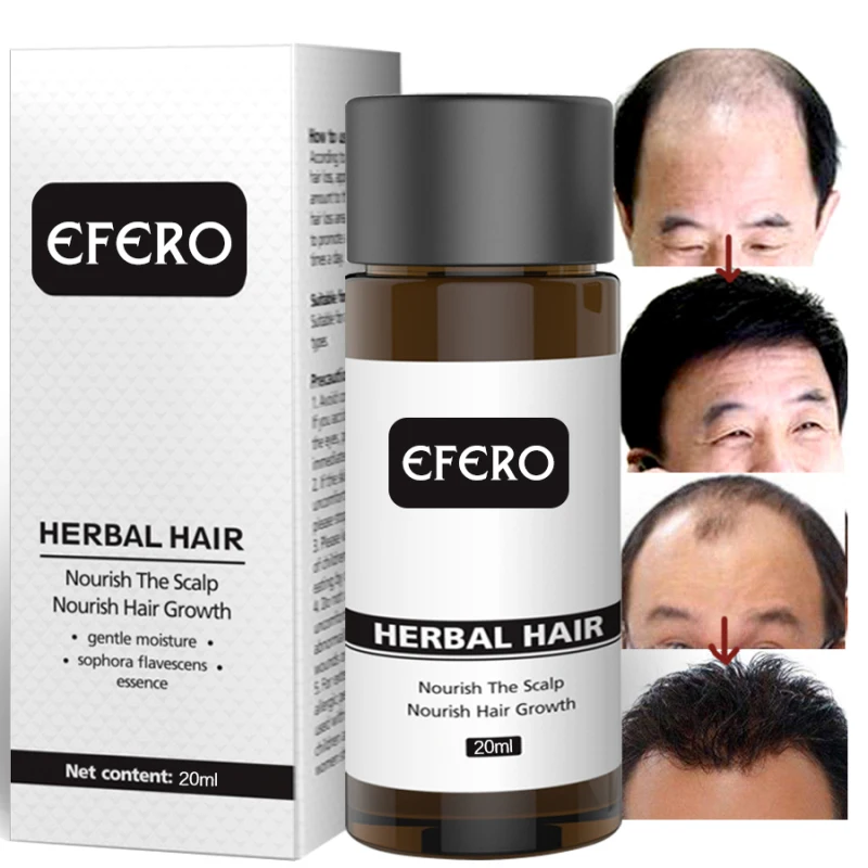 

Drop Ship 20ml Ginger Extract Hair Loss Essential Oil Dense Hair Growth Serum Hair Care Prevent Baldness Essential Liquid TSLM2