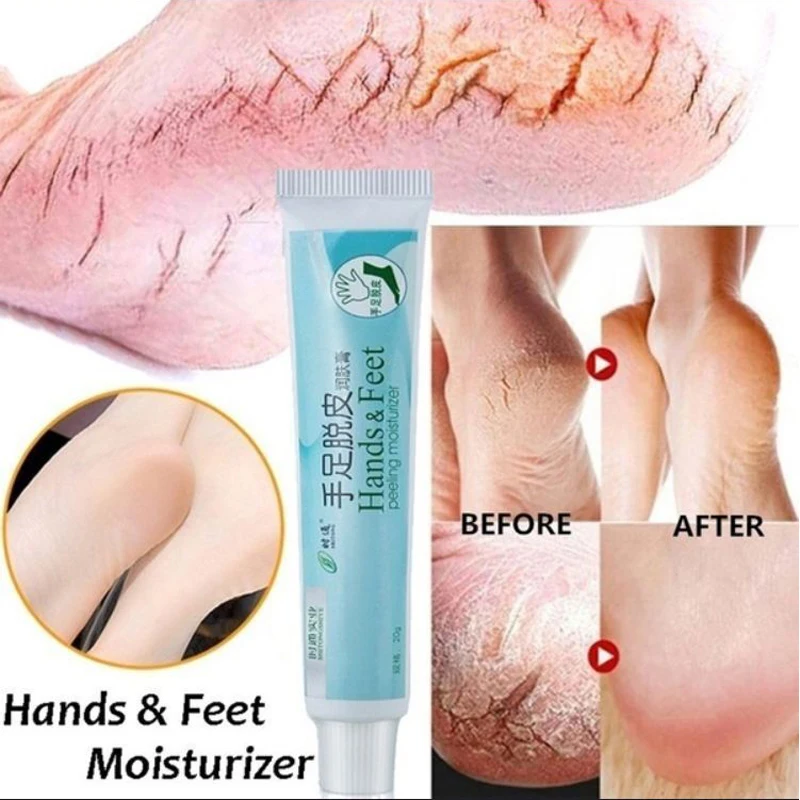 

Traditional Chinese Ointment Cream Anti Dry Crack Repair Heel Foot Balm Exfoliating Foot Cream Hand Cracked Heel Cream Feet Care