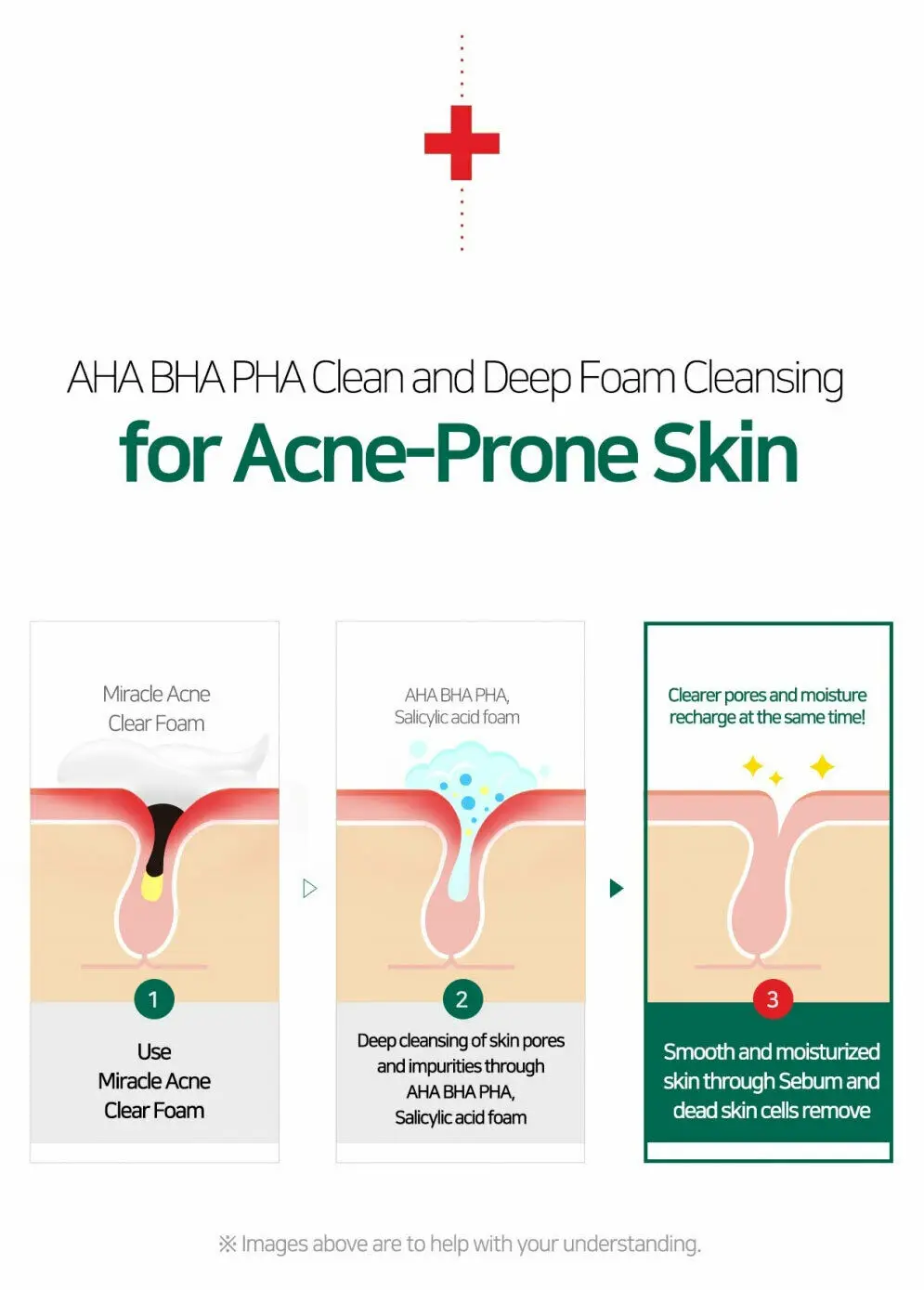 Некоторые MI ана BHA ПГА 30 дней чудо Acne Clear пены 100 мл Очищающее Средство для удаления