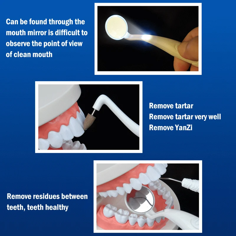 3 шт. светодиодный набор для чистки зубов Стоматологическое зеркало+ удаление зубного налета+ Зубное пятно ластик осмотр удаление от зубных пятен уход за полостью рта TSLM1