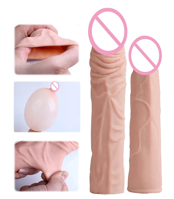 101