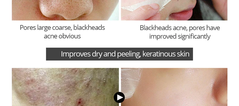 Алоэ Вера Tear маска blackhead Remover Нос Маска для очищения пор черная маска пилинг акне лечение Черный глубокое очищение уход за кожей