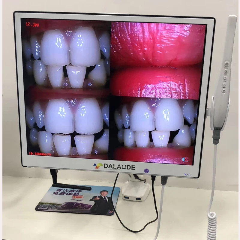 Зубная камера ротовой полости эндоскопа бороскоп 17 дюймов HD мультимедиа мониторы для dentista Wi Fi беспроводной