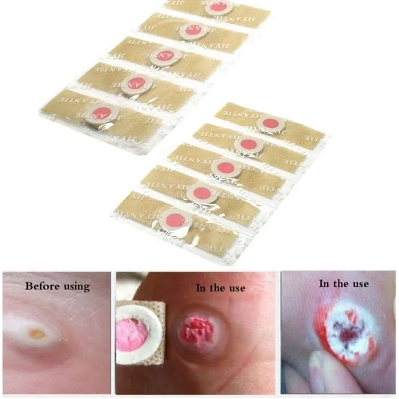 

10pcs/lot Foot Care Medical Plaster Foot Corn Remover Calluses Plantar Warts Thorn Plaster Pies Health Care For Relieving Pain