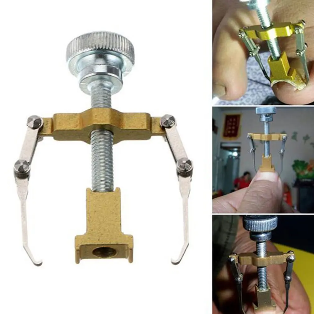 Ingrown Toe Nail Correction Tool Manicure Clipper Pedicure Fixer Recover Pro Foot Nail Care Orthotic Nail Bunion Corrector