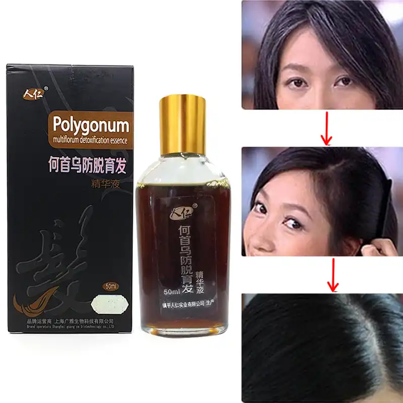 Traditional Chinese Medicine Cure White Hair Turn Gray Black