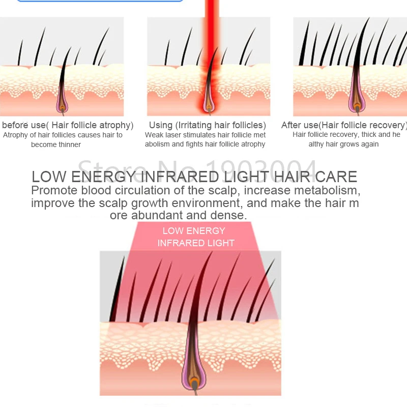 Hair Regrow Laser Helmet Hair Follicle Repair Treatment Hair Loss