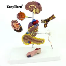 Authentic Medical Human Medicine Diabetes Model Head Heart Pancreatic Neuron Model Internal Surgical Anatomical Model Authentic Medical Human Medicine Diabetes Model Head Heart Pancreatic Neuron Model Internal Surgical Anatomical Model