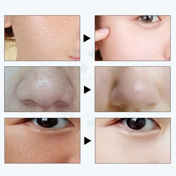 

Shrink Pores Hyaluronic Acid Essence Moisturizing Plant Anti Wrinkle Skin Care MH88