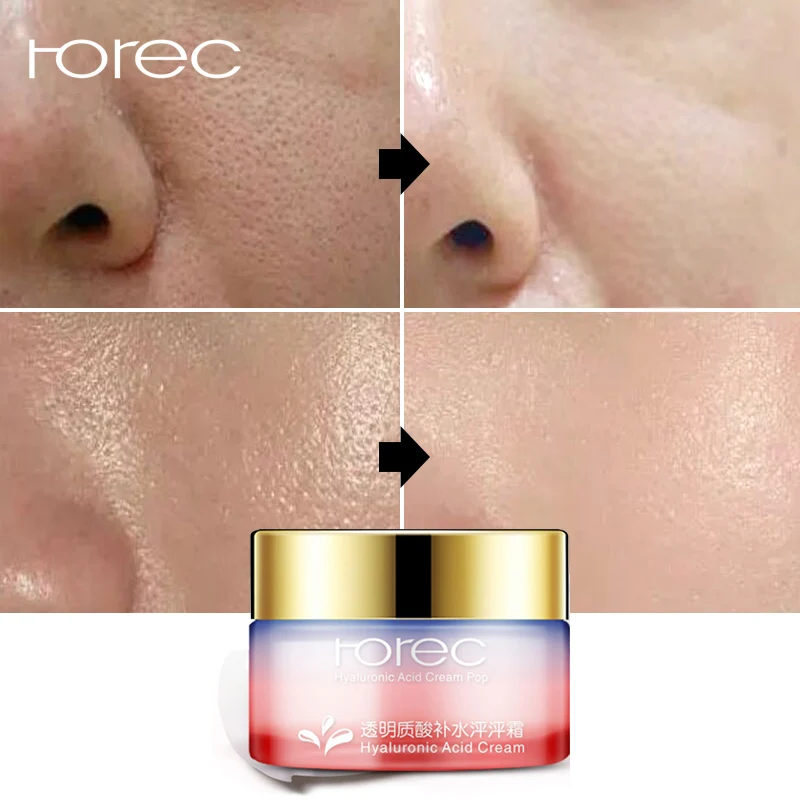 

ROREC Hyaluronic Acid Face Cream Vitamin C Moisturizer Anti Wrinkle Melasma Whitening Cream Remover Pigmentation Lifting Skin