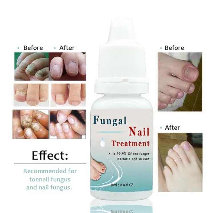Kills 99.9 Bacteria Fungus Nail Fungus Treatment Cuticle Oil