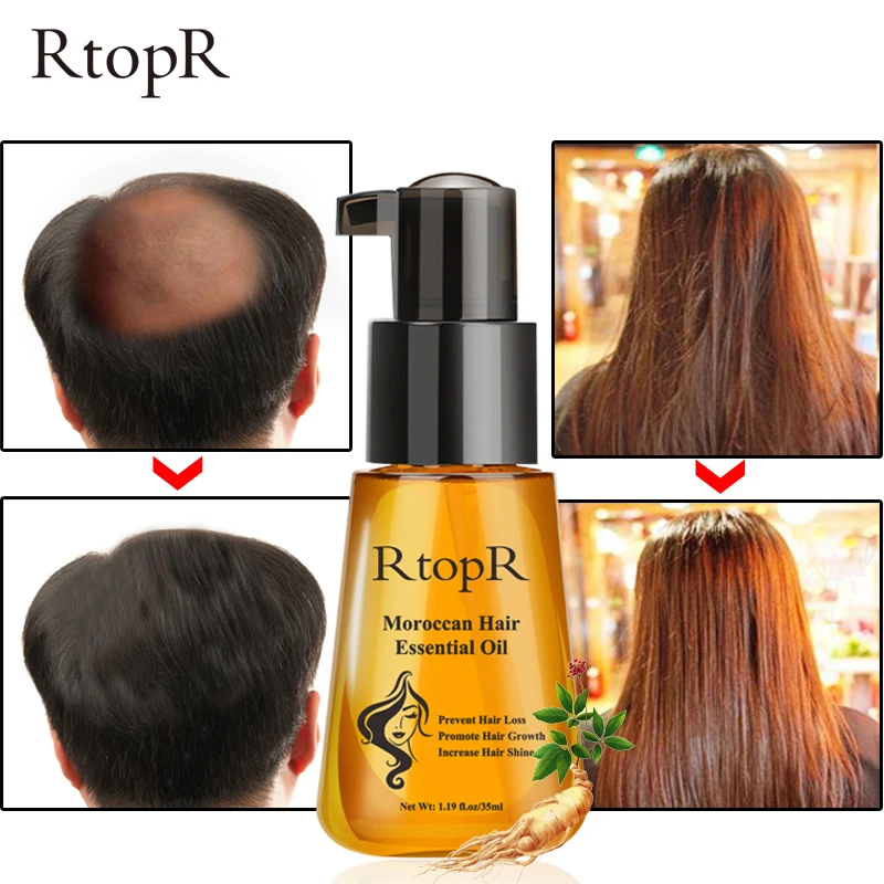 Марокканский продукт от выпадения волос для роста волос эфирное масло легко переносить волосы для ухода 35 мл как мужской, так и женский применение TSLM2