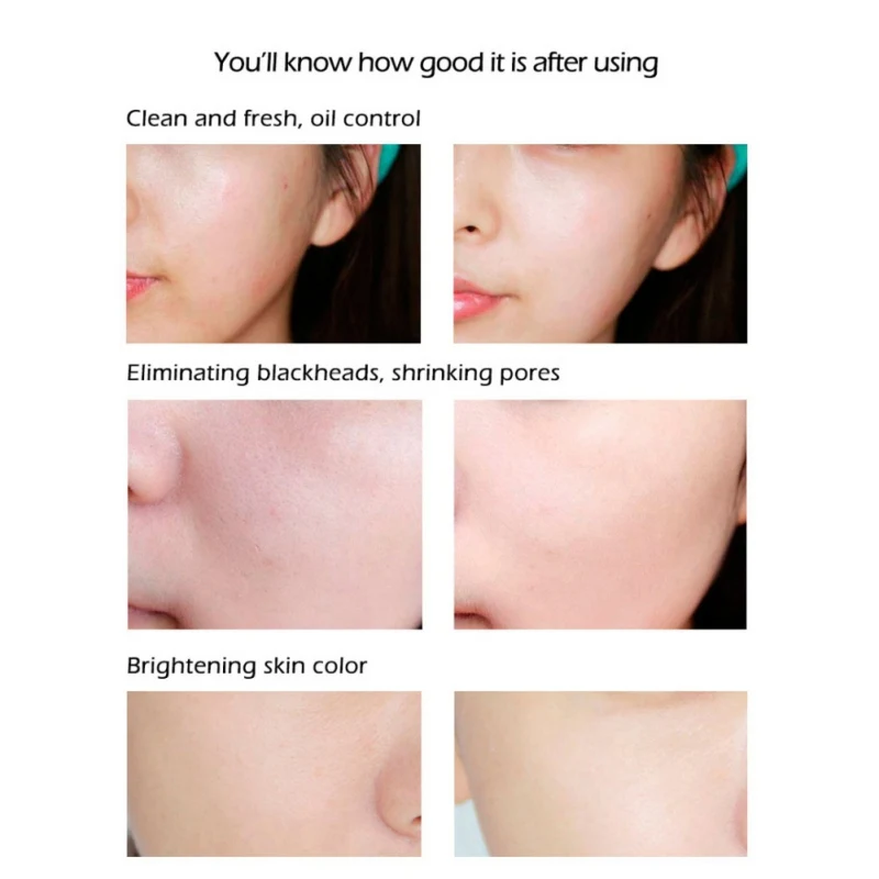 80g-Blackhead-Remover-Ecophy-Seven-Chinese-Medicine-White-Face-Soap-Cleanser-Acne-Treatment-Beauty-Skin-Care (6)