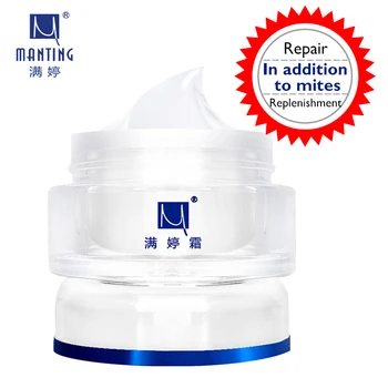 

Hot! Free shipping ManTing cream Mite bug busters face care acne treatment scars ance remover cream removing blain accusing oil