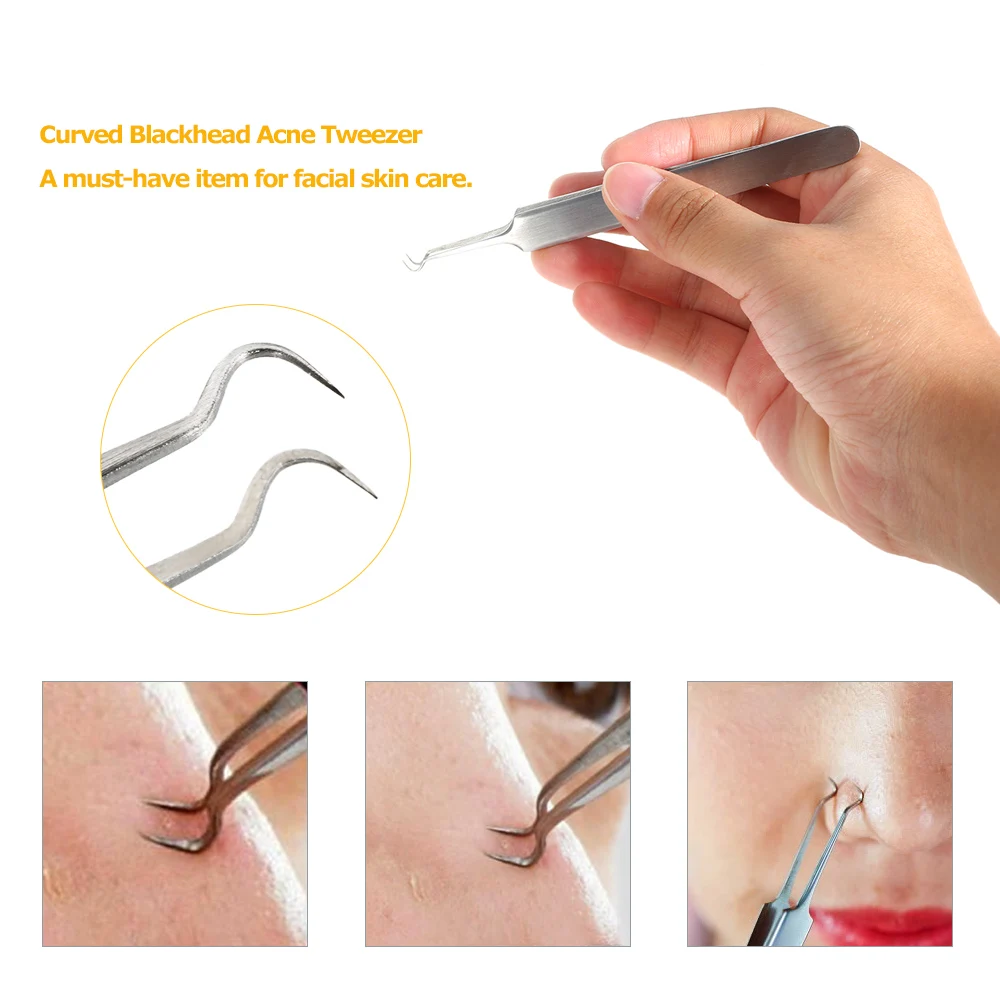 Bend Curved Blackhead Acne Clip Tweezer Stainless Steel Pimple Comedone Remover Extractor Facial Skin Cleaning Tool | Красота и