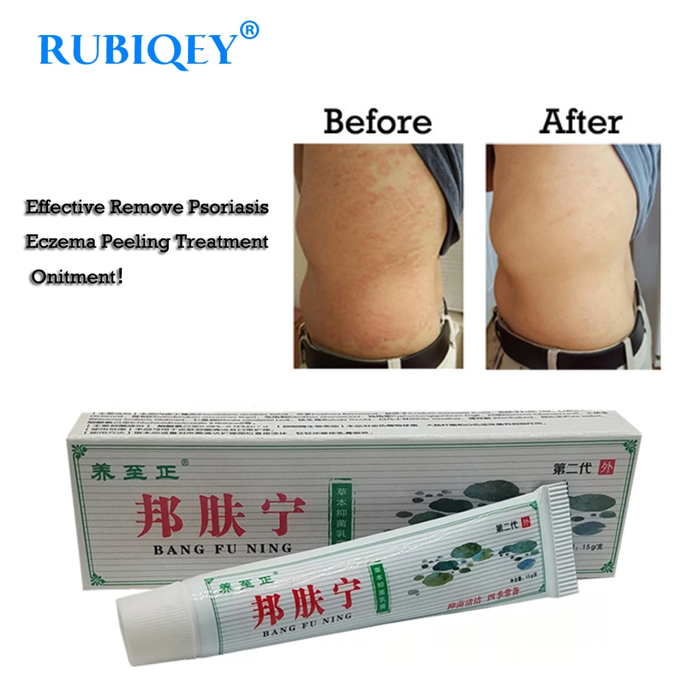 

Body Psoriasis Cream Perfect For Dermatitis and Eczema Pruritus Psoriasis Ointment Herbal Creams RUBIQEY