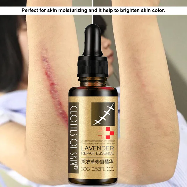 Лавандовое восстанавливающее эфирное масло Разбавьте крем для удаления акне