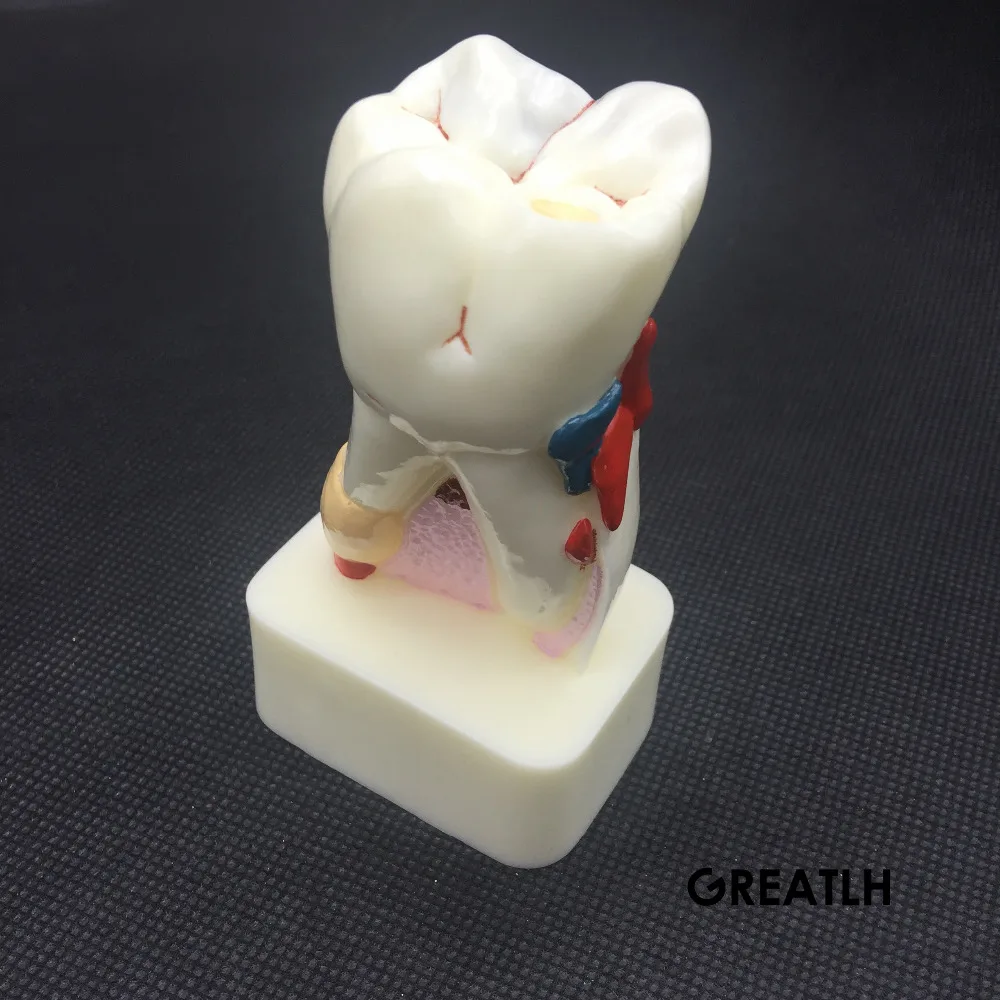 Лучший Стоматолог Стоматологическое исследование научить Зуб модель зубов Модель болезни модель новая