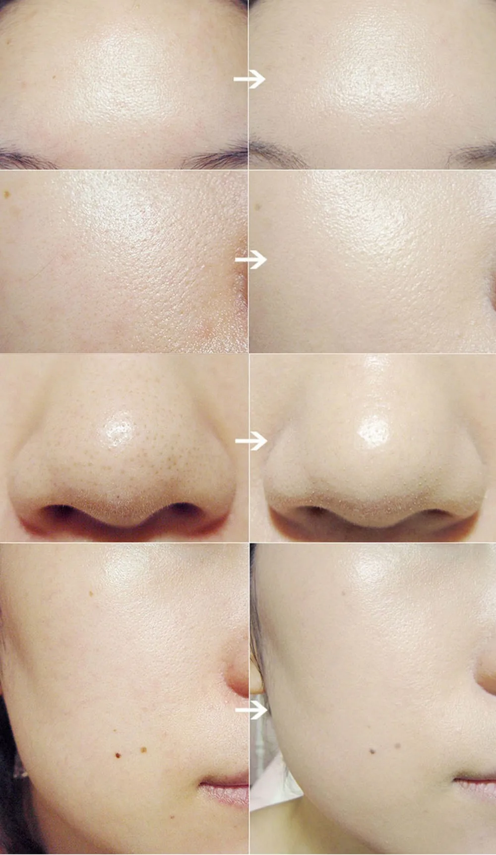 Electric Wash Face Brush Machine Facial Pore Cleaner Body Cleaning Skin Massager Beauty Tools Wash Face Machine (12)