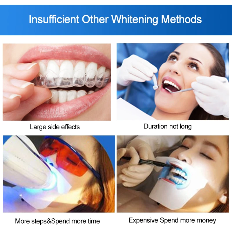 1 шт., ежедневное очищение зубов, 3D отбеливающие инструменты, отбеливающие полоски для зубов, гель, стоматологическое Осветление и отбеливание зубов, виниры для зубов TSLM2