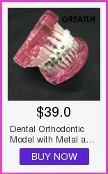 dental com dentes modelo padrão removíveis 4004 01 estudo dental ensine teeth modelo 28 Modelo padrão dental com dentes removíveis #4004