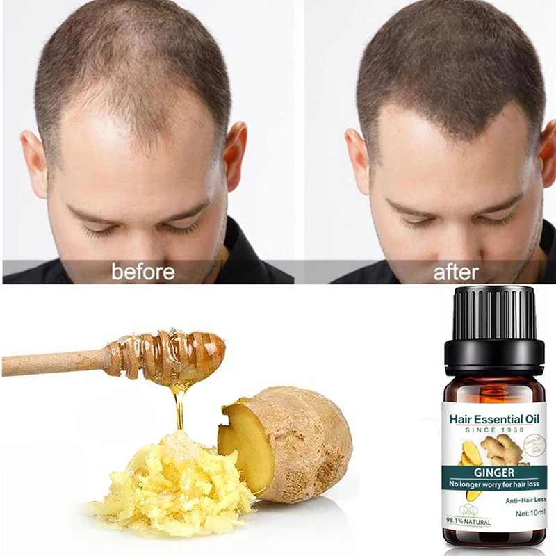 Уход за волосами имбирь эфирное масло питательное средство для кожи головы и волос против сушки средство для роста волос