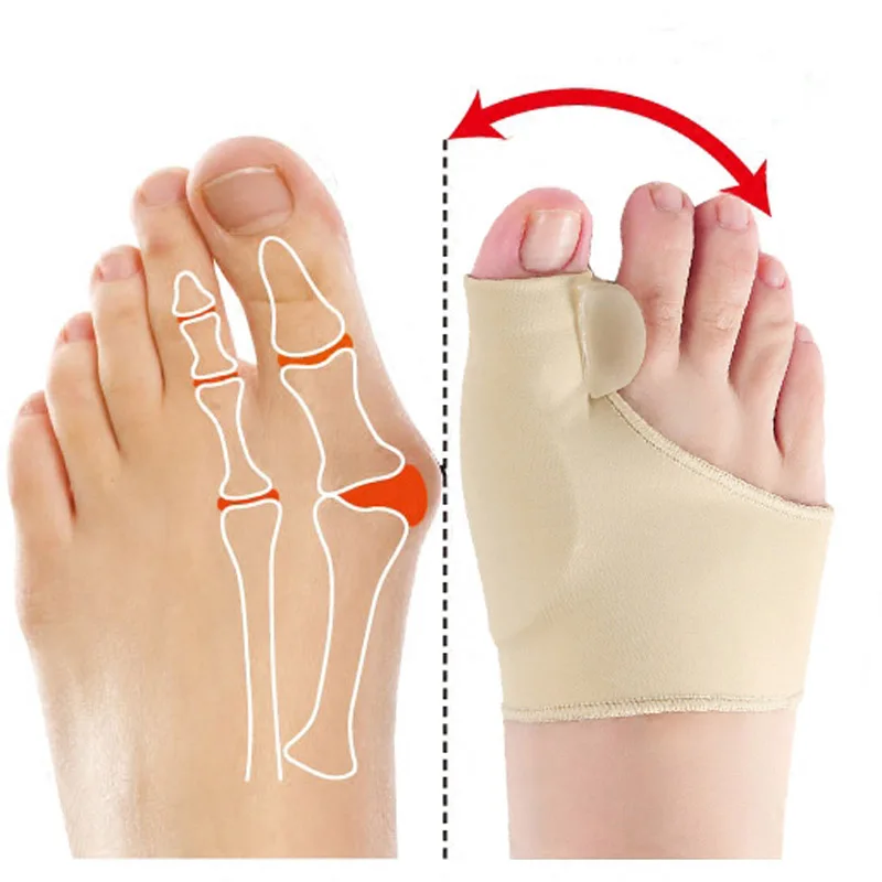 1 пара ортопедических носков для коррекции больших костей, педикюра, силиконовые корректоры вальгусной деформации, подтяжки, разделители пальцев ног, инструмент для ухода за ногами